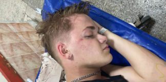 Чоловіка, що побив танцівника балету Дорофеєвої, взяли під варту